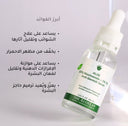 سيروم النياسيناميد 10% + الزنك 1%